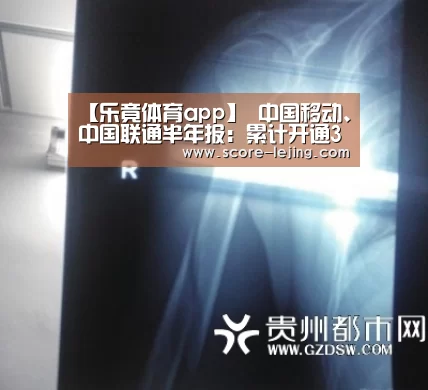 【乐竟体育app】
中国移动、中国联通半年报:累计开通39.8万5G基站!(图2) 乐竟体育app